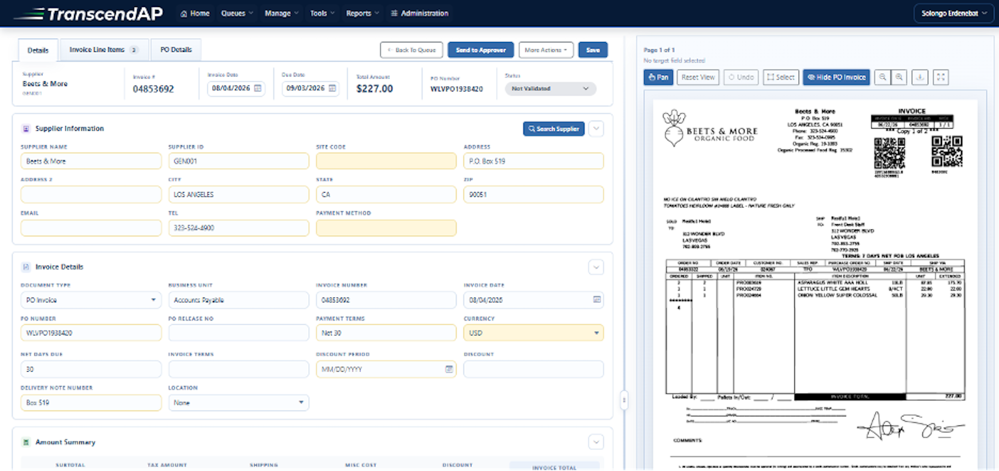 detail view of touchess invoice screen